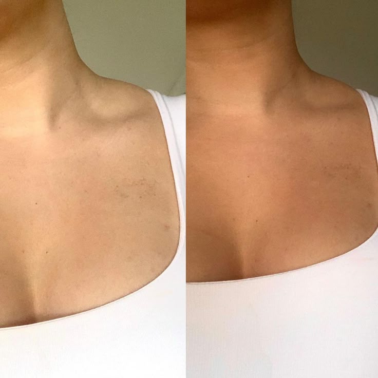files/H_E_L_I_O_U_X___MAUI_BABE_NL_on_Instagram__Before_after_results_of_our_self_tan_mousse_in_medium_shade_The_hydrating_formula_makes_it_so_easy_to_blend_into_the_skin_especially.jpg